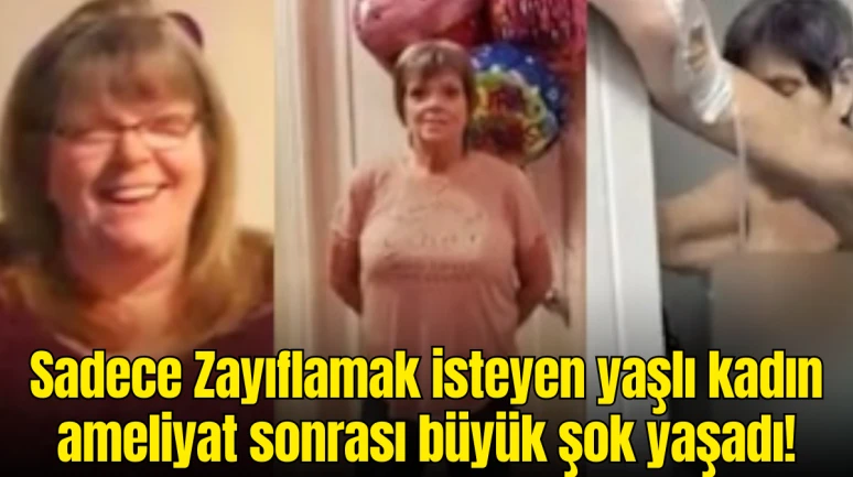 Ameliyatla Zayıflamak İsteyen Kadın Uyandığında Şok Oldu! Göğüs Silikonu ve Brezilya Poposu Eklenmiş